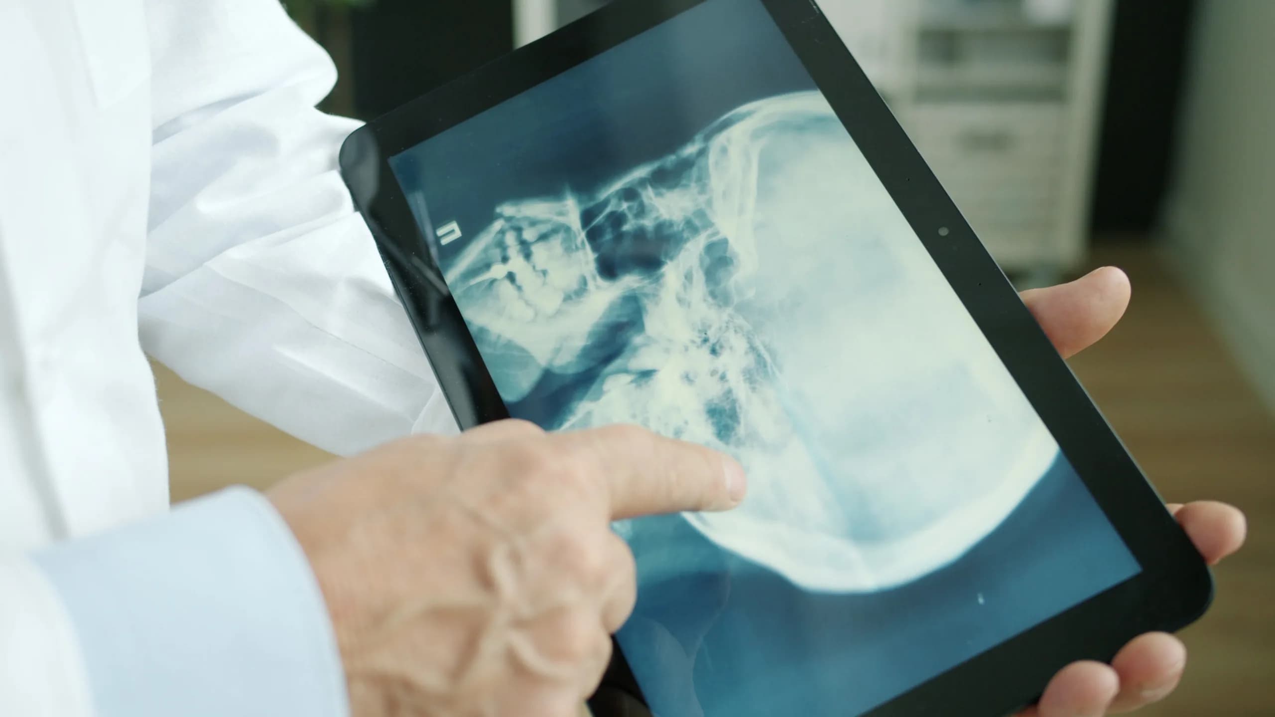 Bone Weekning Indian kids risk weak bones as screen time rises, doctors warn | Bengal ...